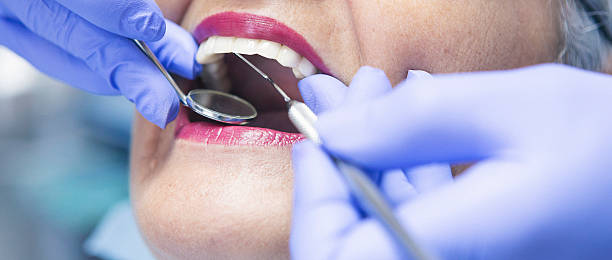 Best Emergency Treatment for Toothache in Ball Pond, CT